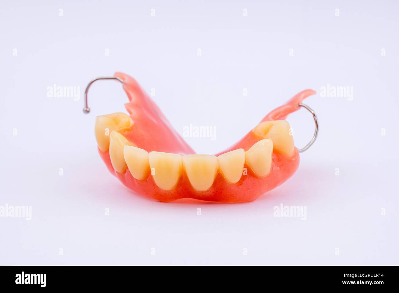 Dentatura rimovibile di una mascella superiore, dentatura, protesi dentale, dentista Foto Stock