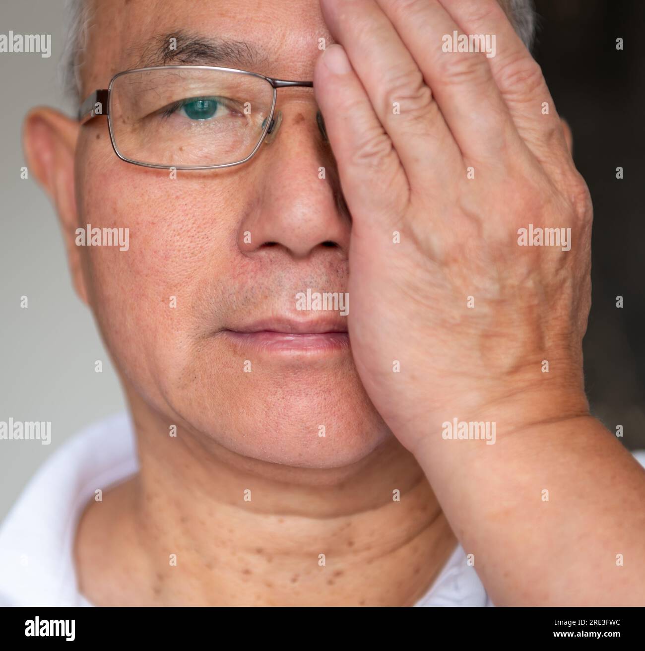 Un uomo che mette alla prova la vista sul suo occhio destro con un paio di occhiali varifocali. Foto Stock