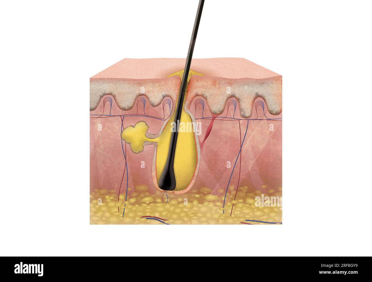 Sezione 2D della pelle con brufolo con epidermide, dermide e ipodermide, ghiandola sebacea, muscolo arrecatore, guaina epiteliale esterna ed interna, fusto dei capelli. Foto Stock