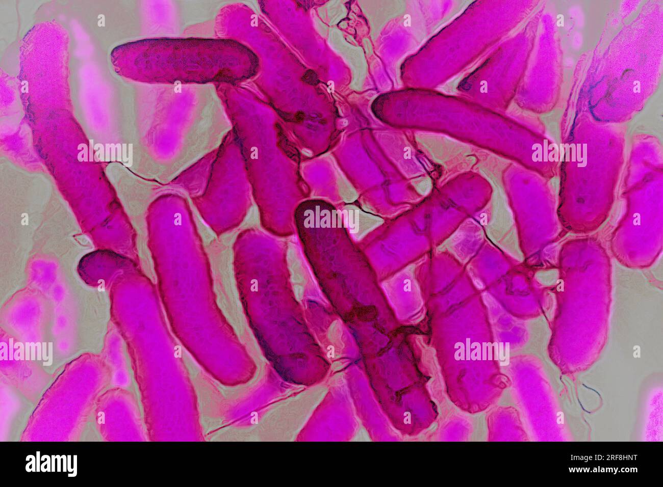 Escherichia coli (batteri intestinali che risiedono nel tratto digerente dell'uomo e degli animali a sangue caldo, è la causa dell'intossicazione alimentare. Foto Stock