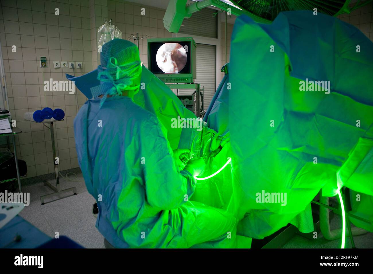 Chirurgia laser per il trattamento dell'iperplasia prostatica benigna. Foto Stock