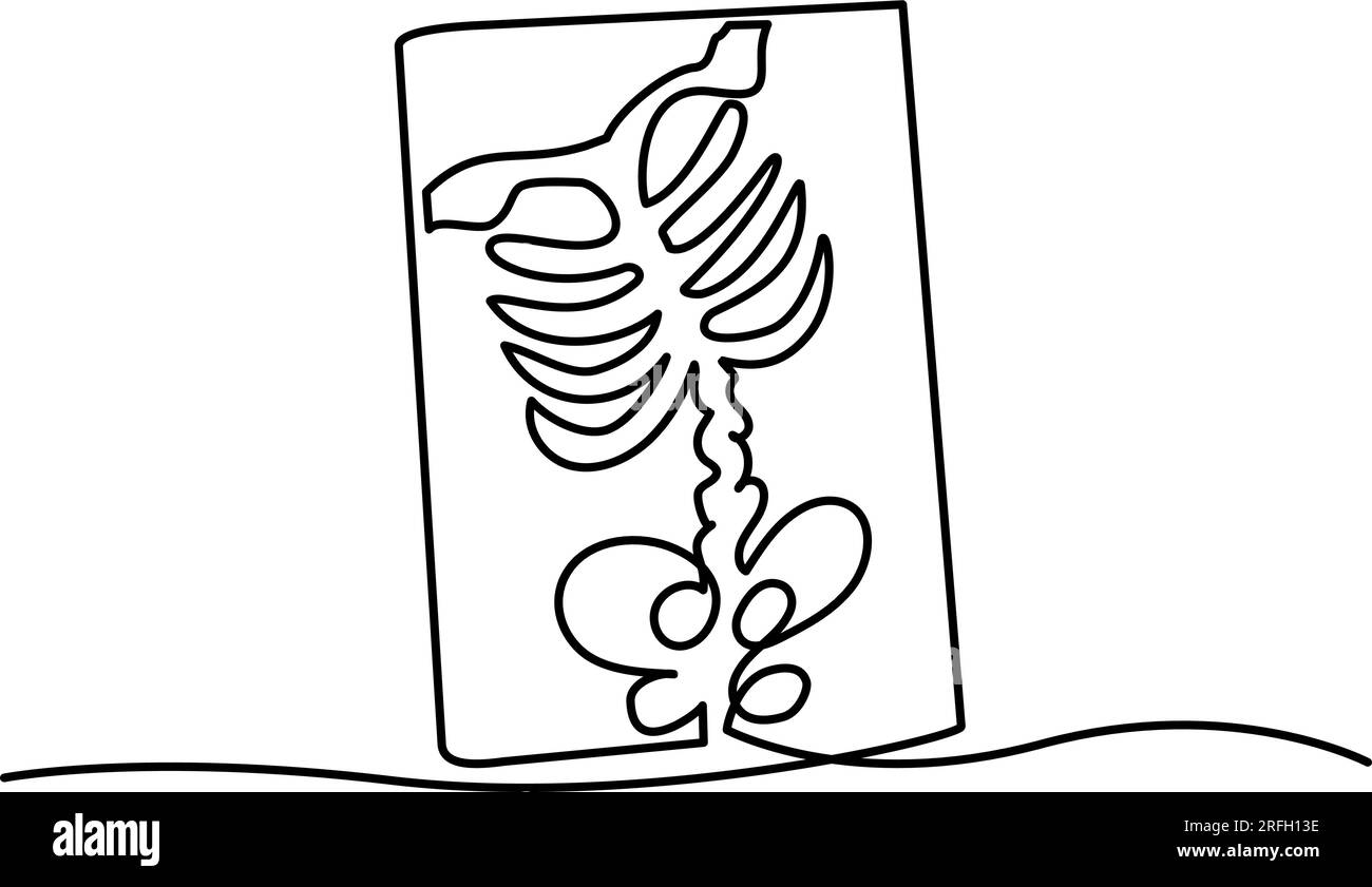 Icona radiografica toracica. Un semplice disegno lineare delle ossa del torace su una radiografia. Vettore isolato su sfondo bianco. Illustrazione Vettoriale