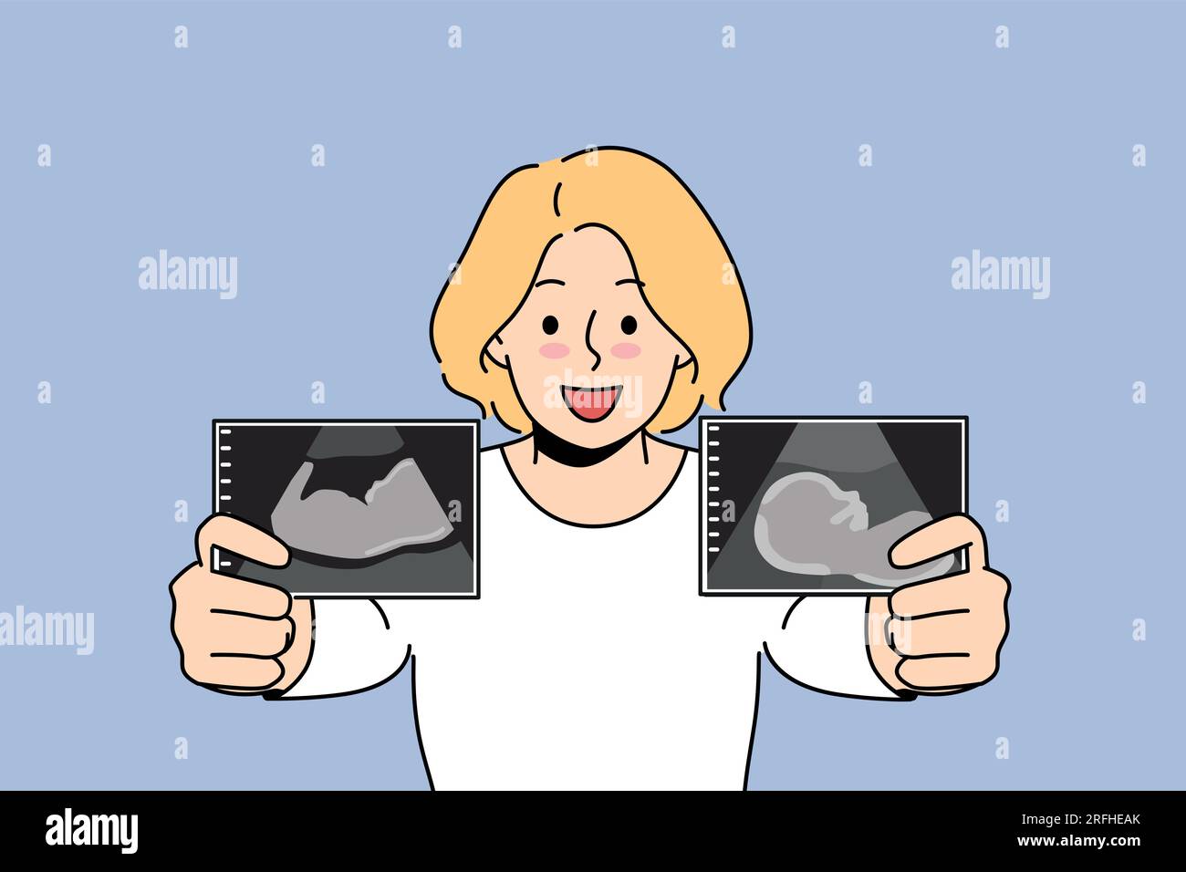 La donna incinta vanta immagini ecografiche del bambino nell'utero della futura madre nel periodo prenatale. La ragazza bionda incinta sorride e si prepara a diventare mamma e dare alla luce un neonato sano Illustrazione Vettoriale