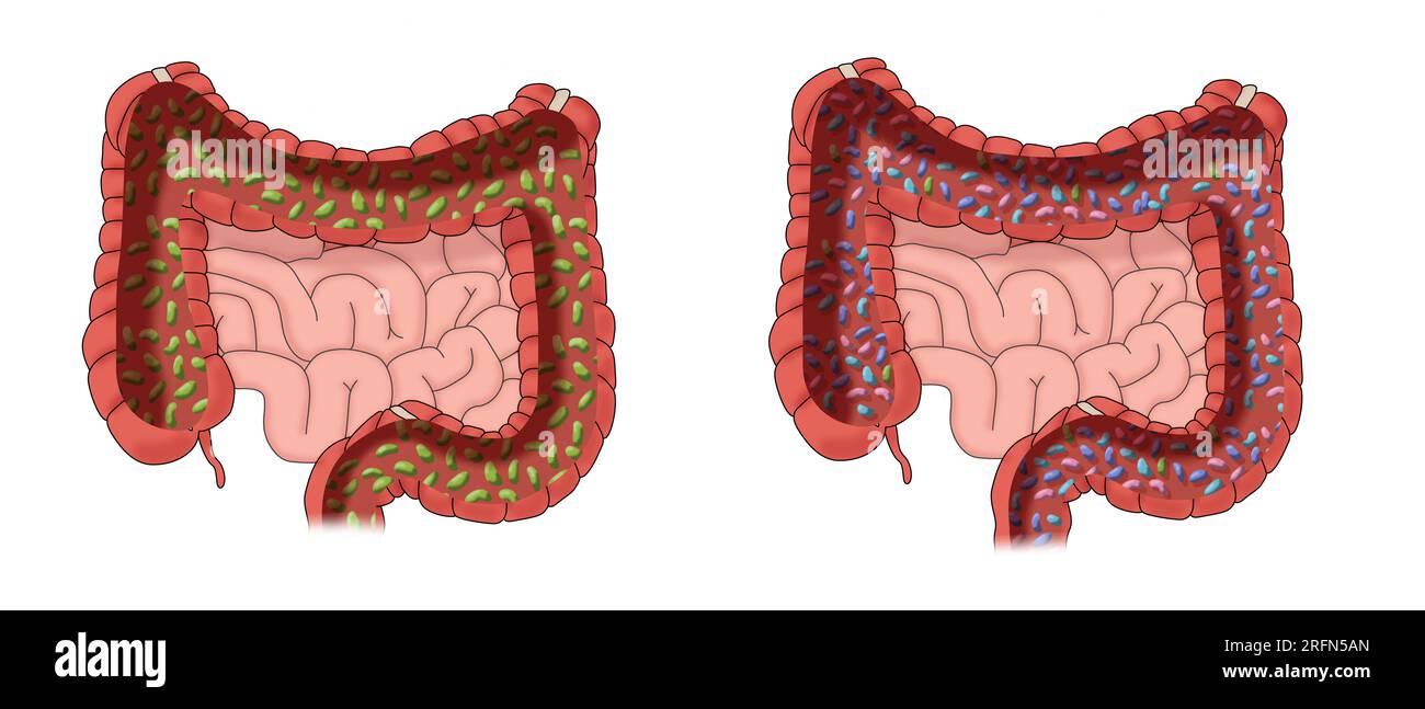 Batteri cattivi e batteri buoni. Un'illustrazione del bioma umano nell'intestino crasso. Foto Stock