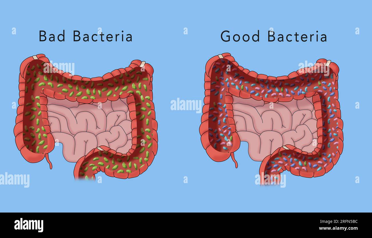 Batteri cattivi e batteri buoni. Un'illustrazione del bioma umano nell'intestino crasso con testo. Foto Stock