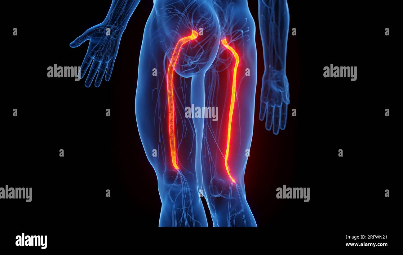 Nervi sciatici, illustrazione Foto Stock