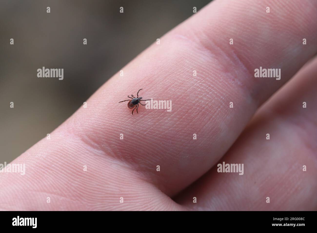 Una zecca che cammina sulla mano. È un aracnide pericoloso che è un vettore di molti agenti patogeni, malattie. Foto Stock