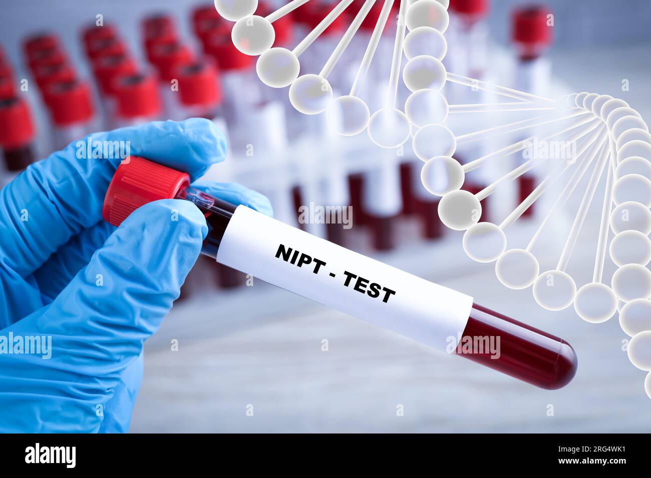 Test prenatali non invasivi (NIPT). Infermiere che tiene la provetta con il campione di sangue in laboratorio, primo piano. Illustrazione della struttura del DNA Foto Stock