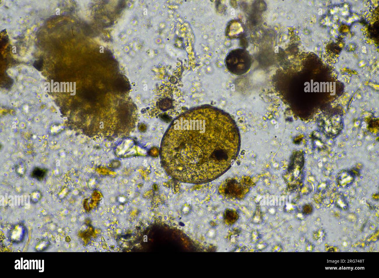 arcella in un campione di tessuto in un laboratorio Foto Stock