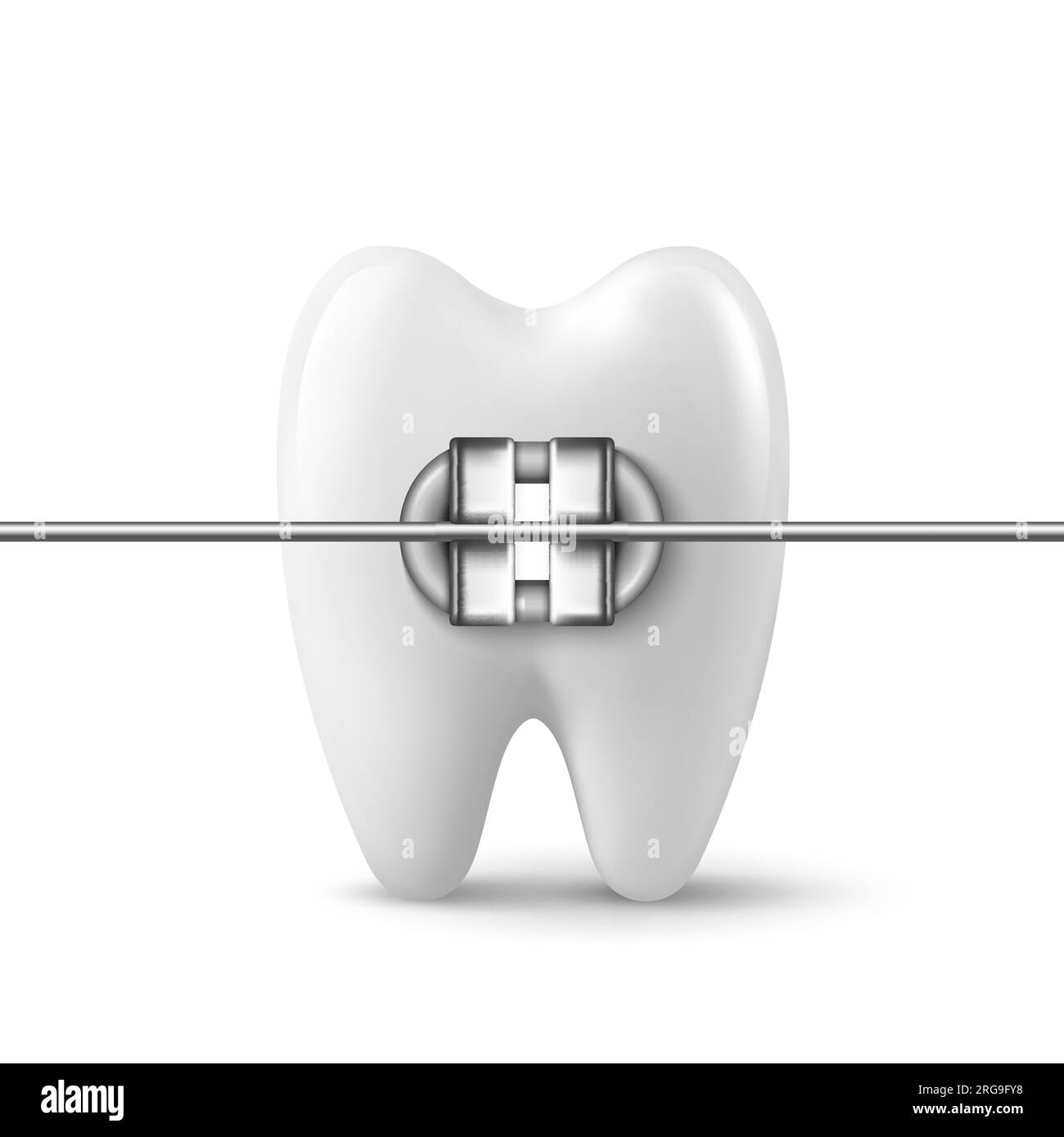 Vettoriale 3d realistico dente con parentesi graffe icona Closeup isolato su sfondo bianco. Modello di progettazione per dentisti medici, Clipart. Concetto di salute dentale Illustrazione Vettoriale