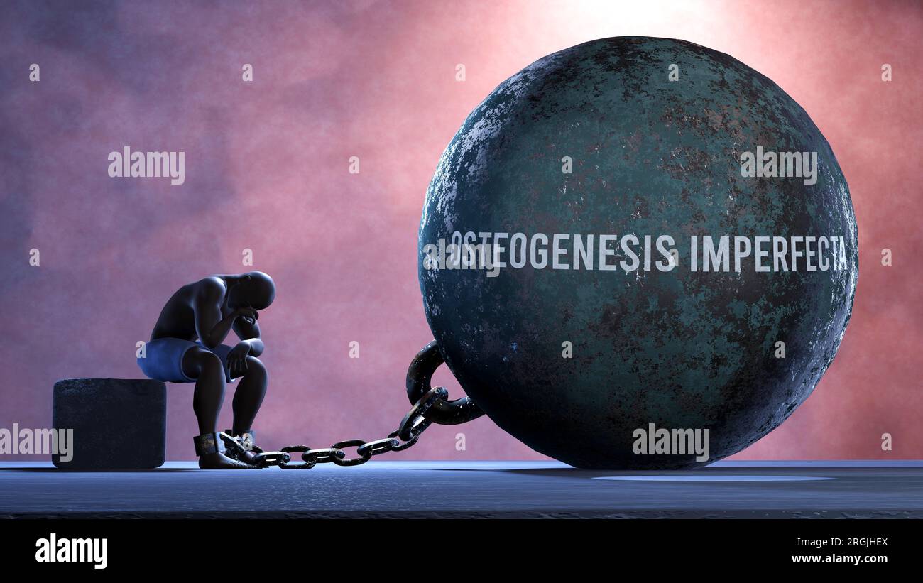 Osteogenesi imperfetta - una metafora che mostra lotta umana con osteogenesi imperfetta.,illustrazione 3D. Foto Stock