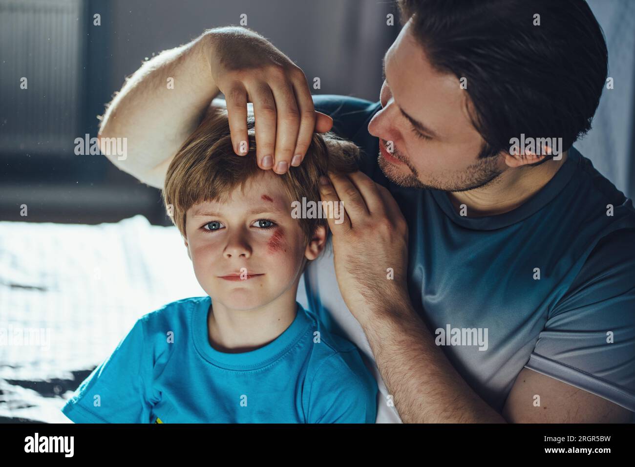 Il padre ispeziona suo figlio con dei graffi sulla faccia dopo la caduta Foto Stock