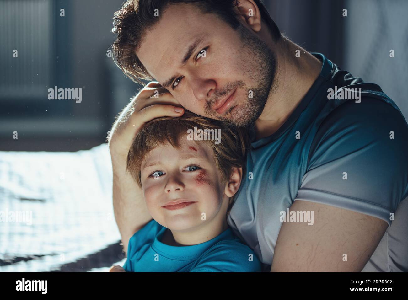 Il padre piange suo figlio con dei graffi sulla faccia Foto Stock
