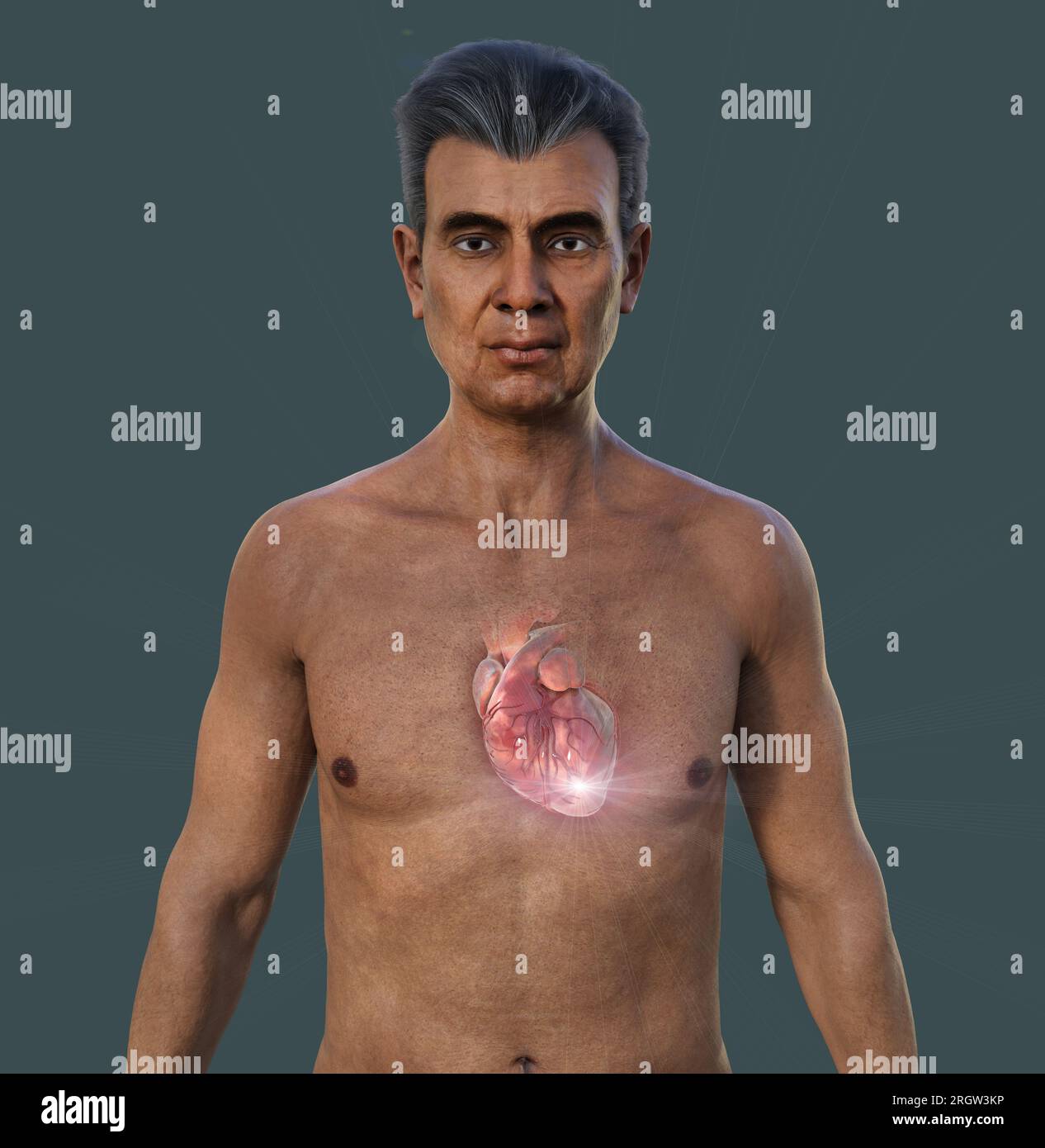 Cuore, illustrazione Foto Stock