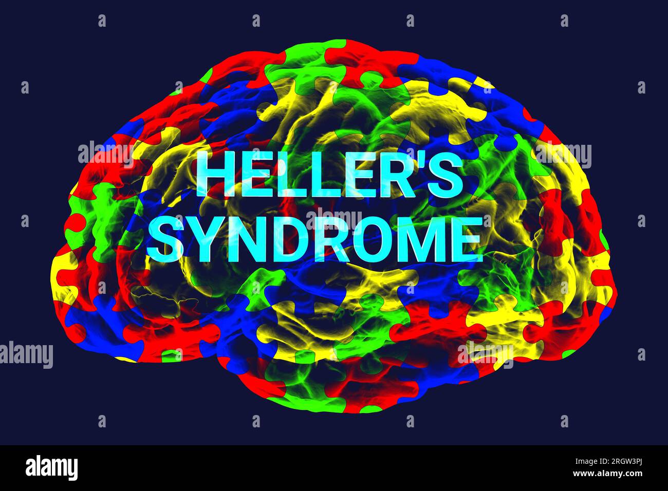 Sindrome di Heller, illustrazione concettuale Foto Stock