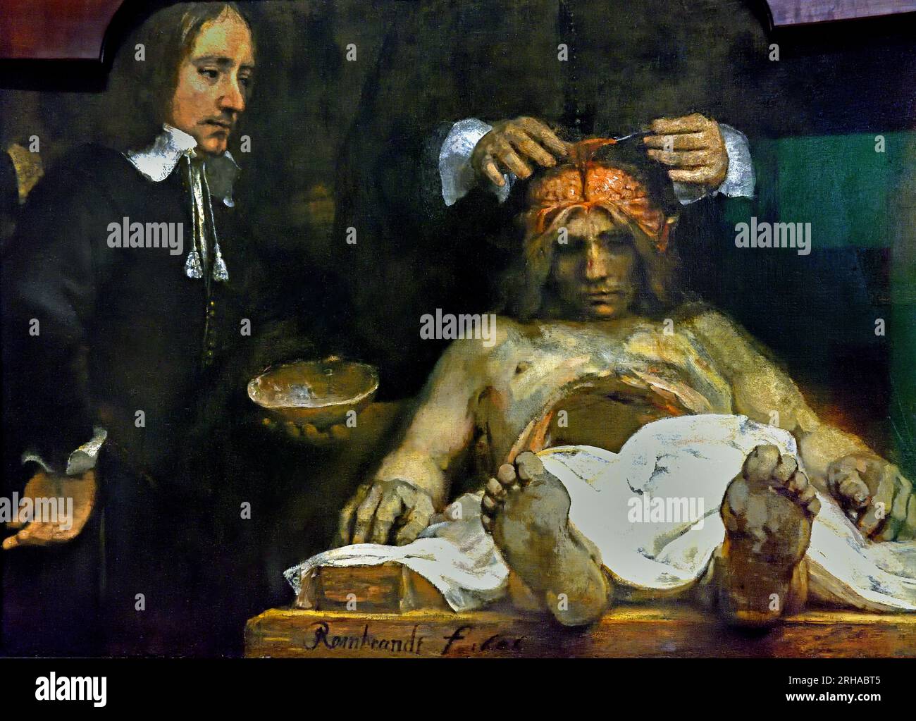 Lezione di anatomia del dr Jan Deijman ( frammento ) 1656 Rembrandt Harmenz van Rijn 1606 - 1669 Dutch, Netherlands, Holland. (Dettaglio) la seconda lezione di anatomia di Rembrandt è un frammento di un ritratto di gruppo. Nel 1723 la maggior parte della tela fu distrutta da un incendio. La sezione centrale rimanente mostra il dottor Jan Deijman che esegue un'autopsia sul cervello di un uomo morto. L'assistente tiene la parte superiore del cranio. Rembrandt ha presentato l'uomo morto in uno scorcio in modo che il tavolo di dissezione sembri sporgere fuori dal quadro. Foto Stock