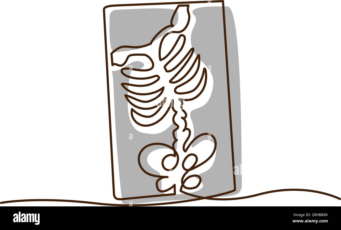 Icona radiografica toracica. Un semplice disegno lineare delle ossa del torace su una radiografia. Vettore isolato su sfondo bianco. Illustrazione Vettoriale