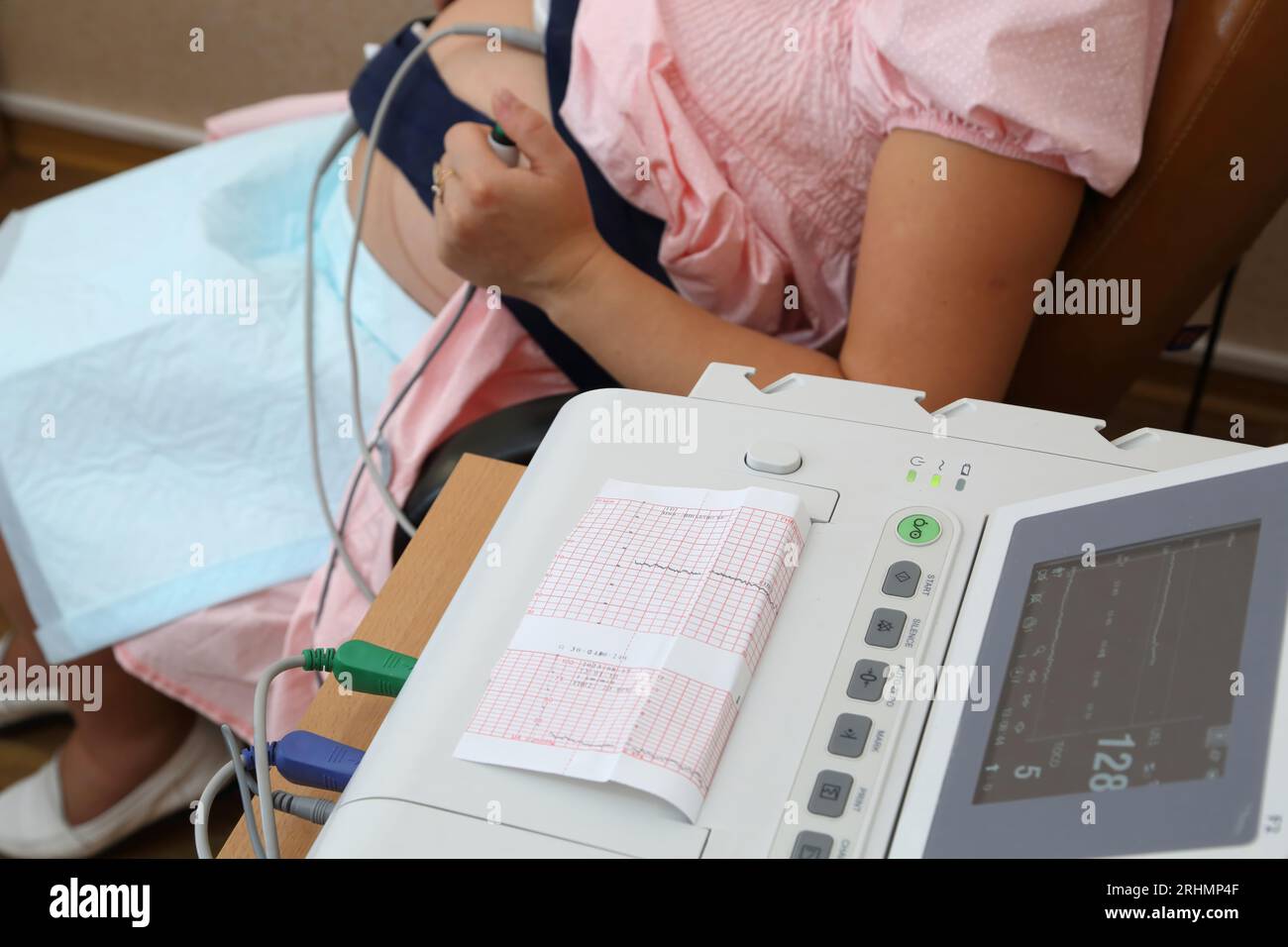 Dispositivo di monitoraggio cardiaco fetale per donne in gravidanza. Monitoraggio cardiaco in gravidanza. Test STV. Monitor cardiaco fetale nelle donne in gravidanza. Cardiogra fetale Foto Stock