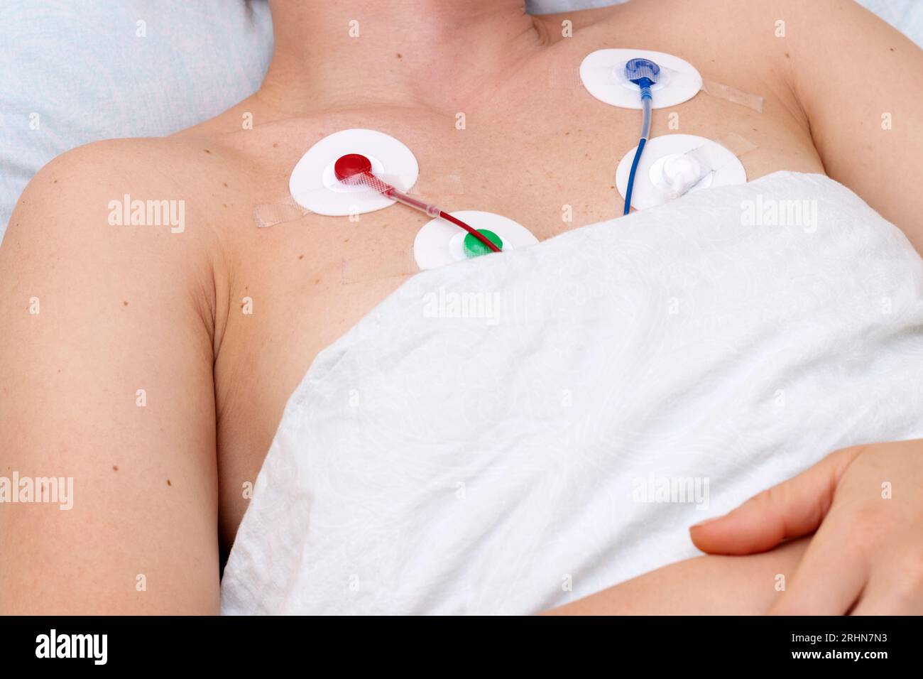 Apparecchiature di monitoraggio Holter sul torace del paziente, assistenza sanitaria e esame medico, esame cardiovascolare, elettrocardiografia. Foto Stock