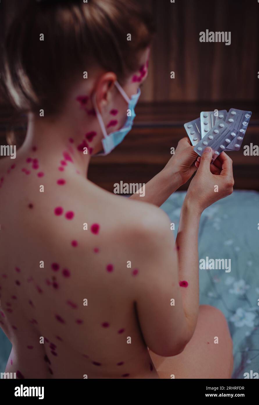 Giovane donna con la varicella che indossa una maschera medica sceglie le pillole Foto Stock