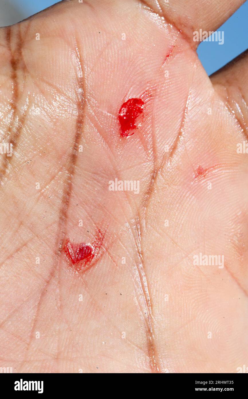 Ferita sanguinante sulla mano di un uomo a seguito di un incidente. Macro di tagli sulla pelle umana con perdita di sangue. Concetto di incidenti sul lavoro. Foto Stock