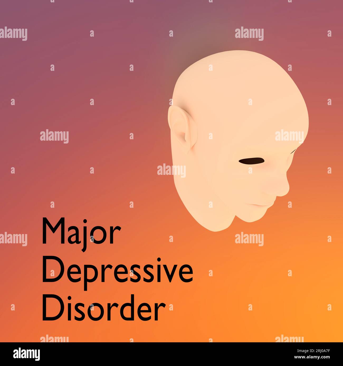 Illustrazione 3D di una testa umana dal titolo disturbo depressivo maggiore, isolata su sfondo di colore scuro. Foto Stock