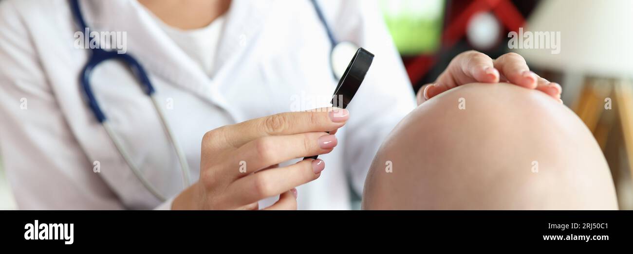 Il medico di sesso femminile guarda la pelle del paziente calvo attraverso la lente d'ingrandimento. Foto Stock