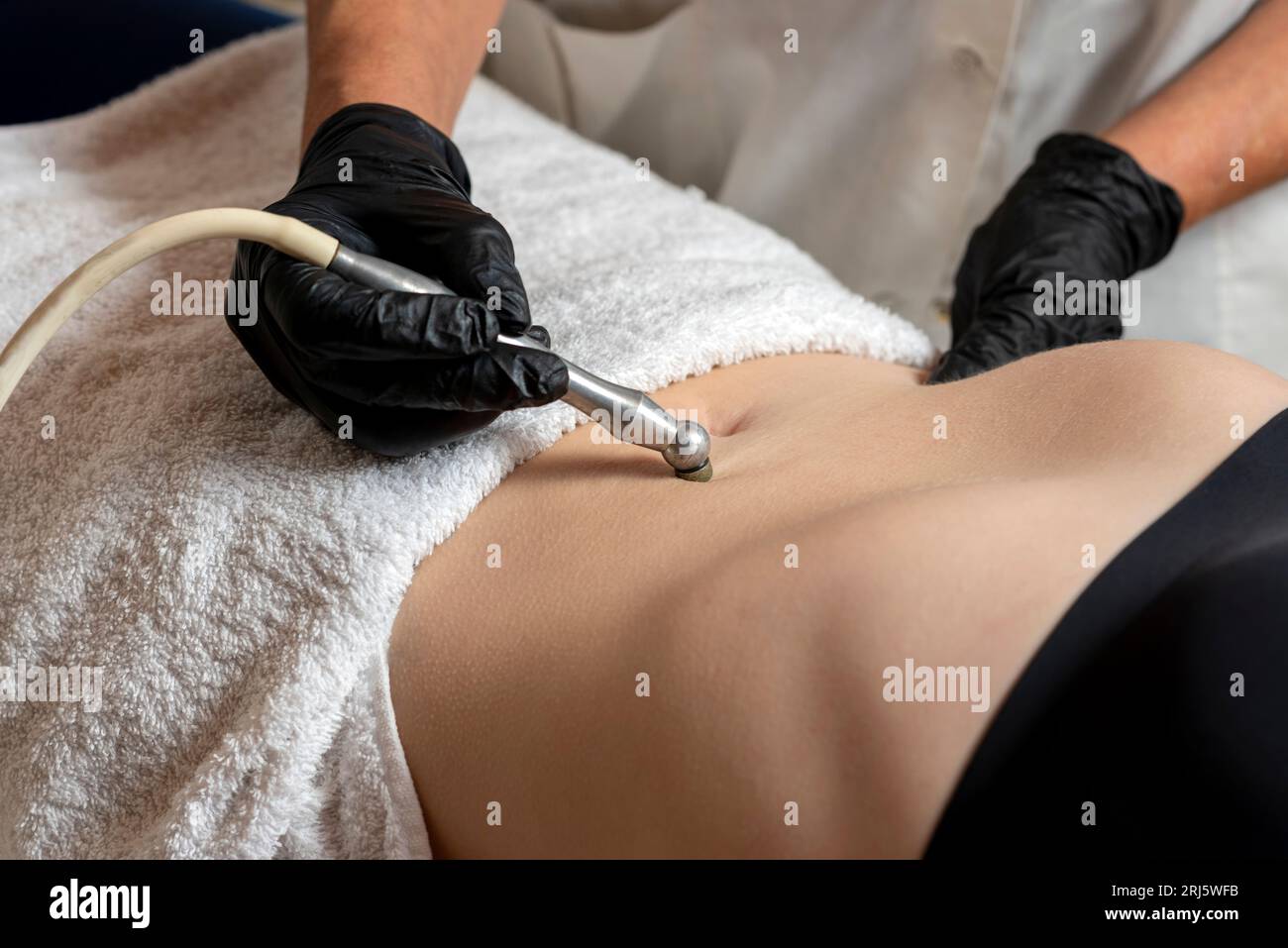 Una paziente che riceve un trattamento estetico del corpo non invasivo con un metodo a punta diamantata per migliorare l'aspetto della pelle e dell'addome Foto Stock