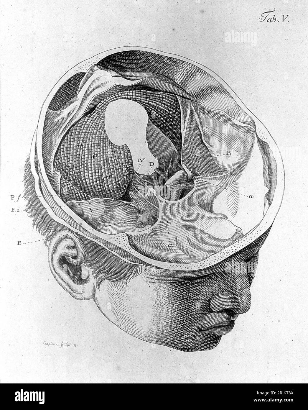 La dissezione del cervello di Christian F. Ludwig. Christian F. Ludwig (1897-1981) è stato un anatomista tedesco che ha sviluppato una tecnica specifica per il cervello Foto Stock