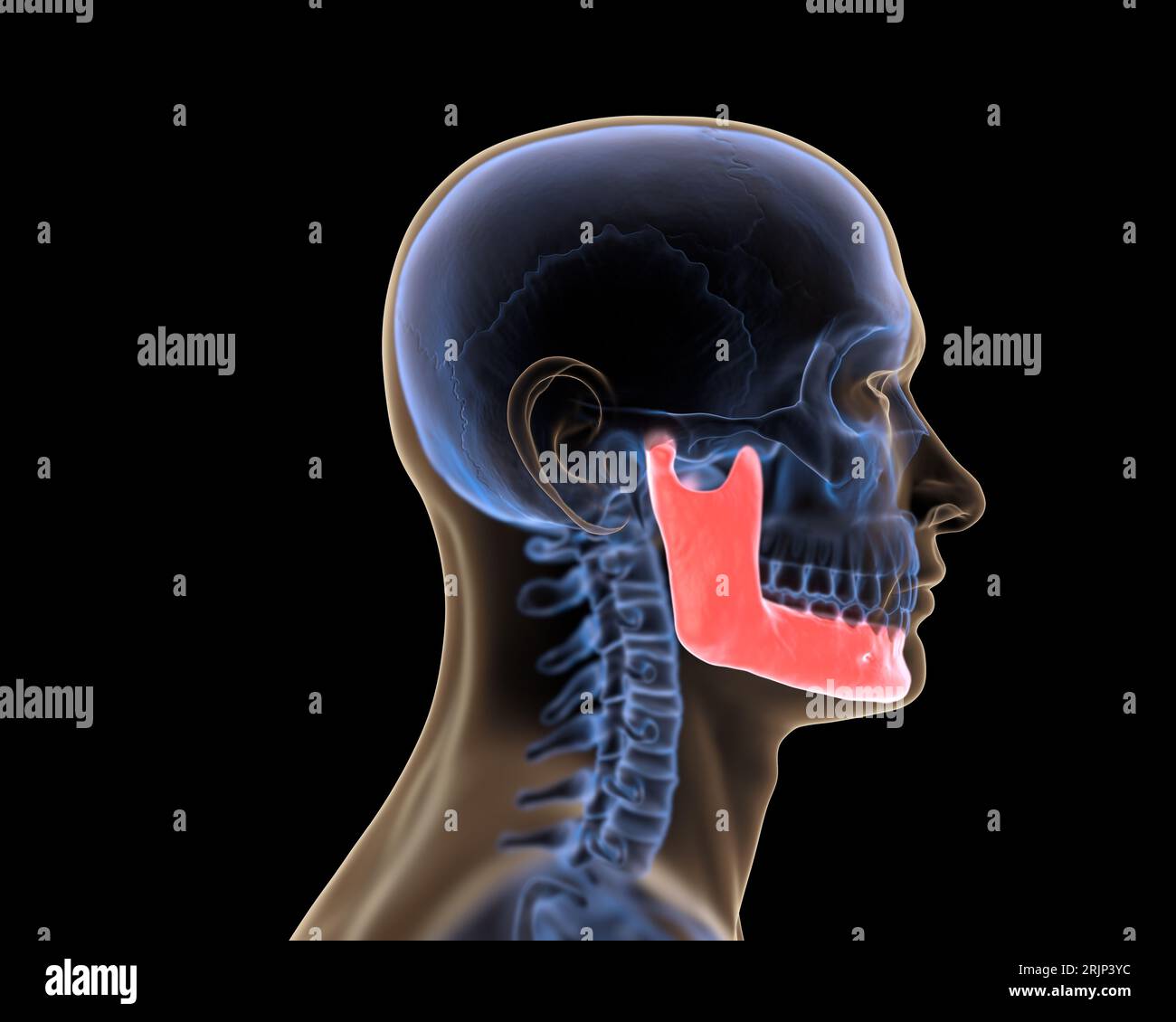 Mandibola a raggi X in rosso Foto Stock