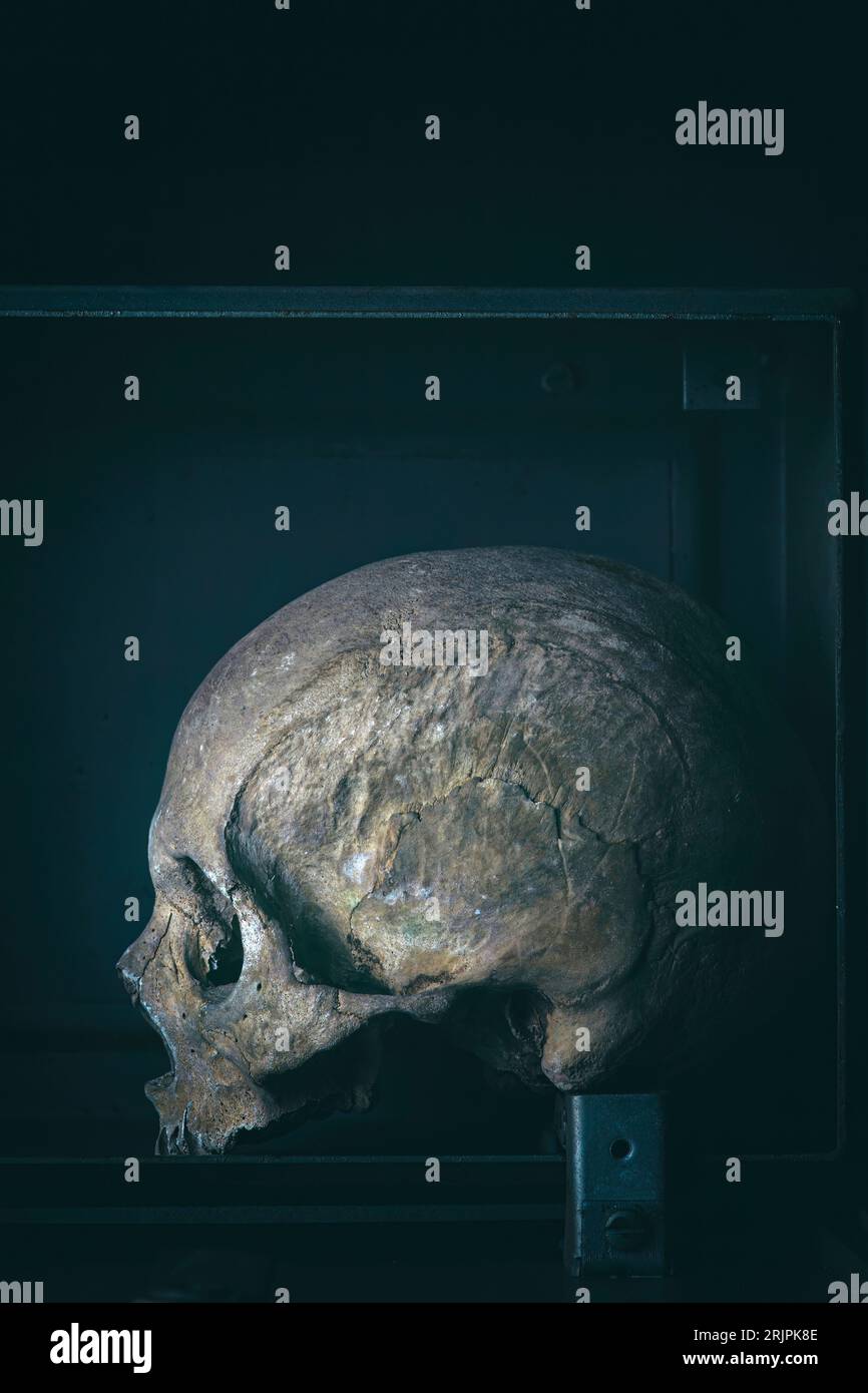 vero cranio umano su fondo scuro in scatola di metallo Foto Stock