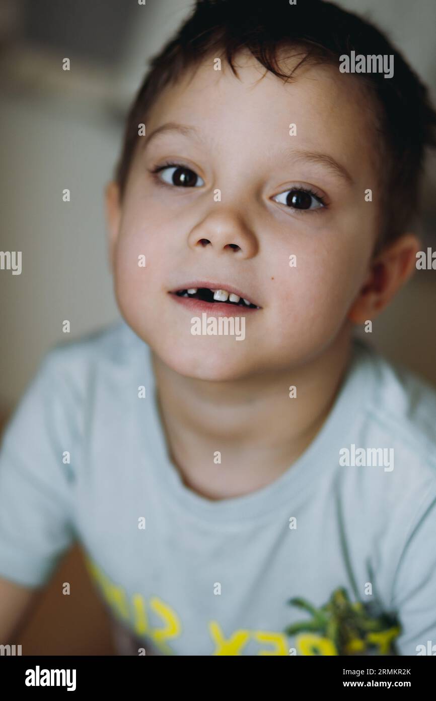 caucasico di 6 anni con il dente anteriore perso. Foto di alta qualità Foto Stock