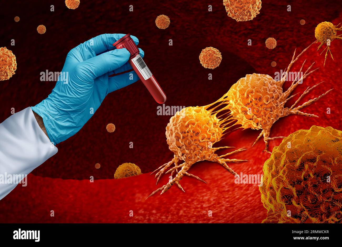 Analisi del sangue del cancro e screening multimaligno per la diagnosi precoce di tumori e cellule tumorali cancerose come genetica e immunoterapia Foto Stock