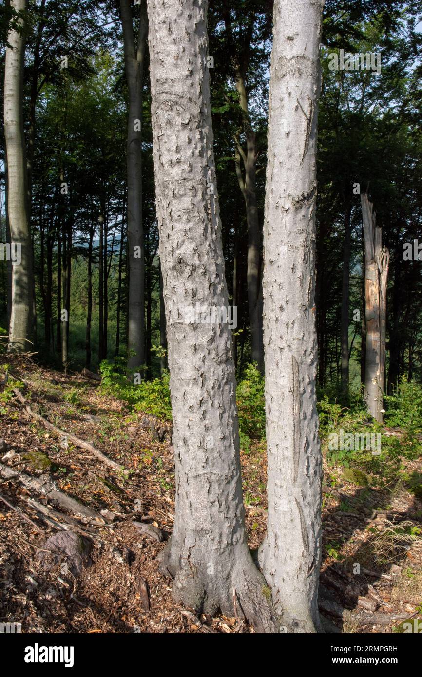 Malattia della corteccia di faggio (BBD). Corteccia di Fagus infestata da Xylococculus betulae, Cryptococcus fagisuga, Neonectria faginata. Foto Stock