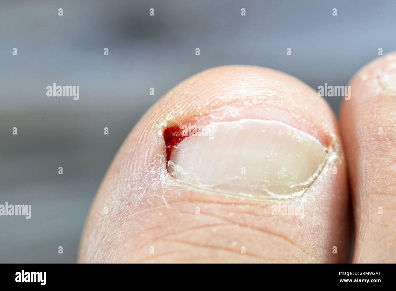 Ossa di un piede destro umano immagini e fotografie stock ad alta ...