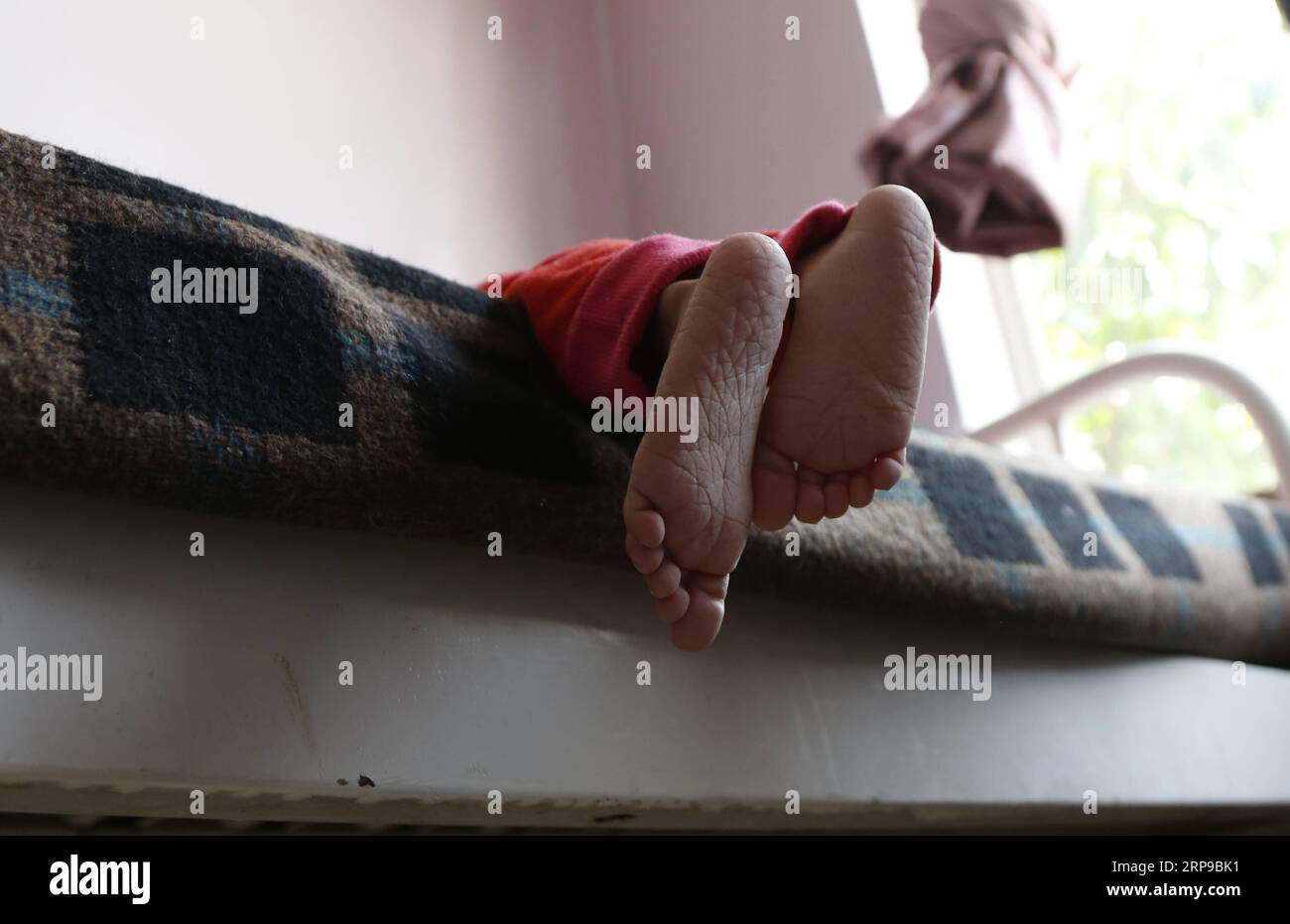 (190401) -- SANAA, 1 aprile 2019 -- i piedi di un bambino malnutrito si vedono in un centro di cura per la malnutrizione a Sanaa, Yemen, il 1 aprile 2019. Secondo il Fondo delle Nazioni Unite per l'infanzia (UNICEF), circa 394.000 bambini yemeniti sotto i 5 anni soffrono di grave malnutrizione acuta e necessitano di cure. YEMEN-SANAA-BAMBINI-MALNUTRIZIONE MohammedxMohammed PUBLICATIONxNOTxINxCHN Foto Stock