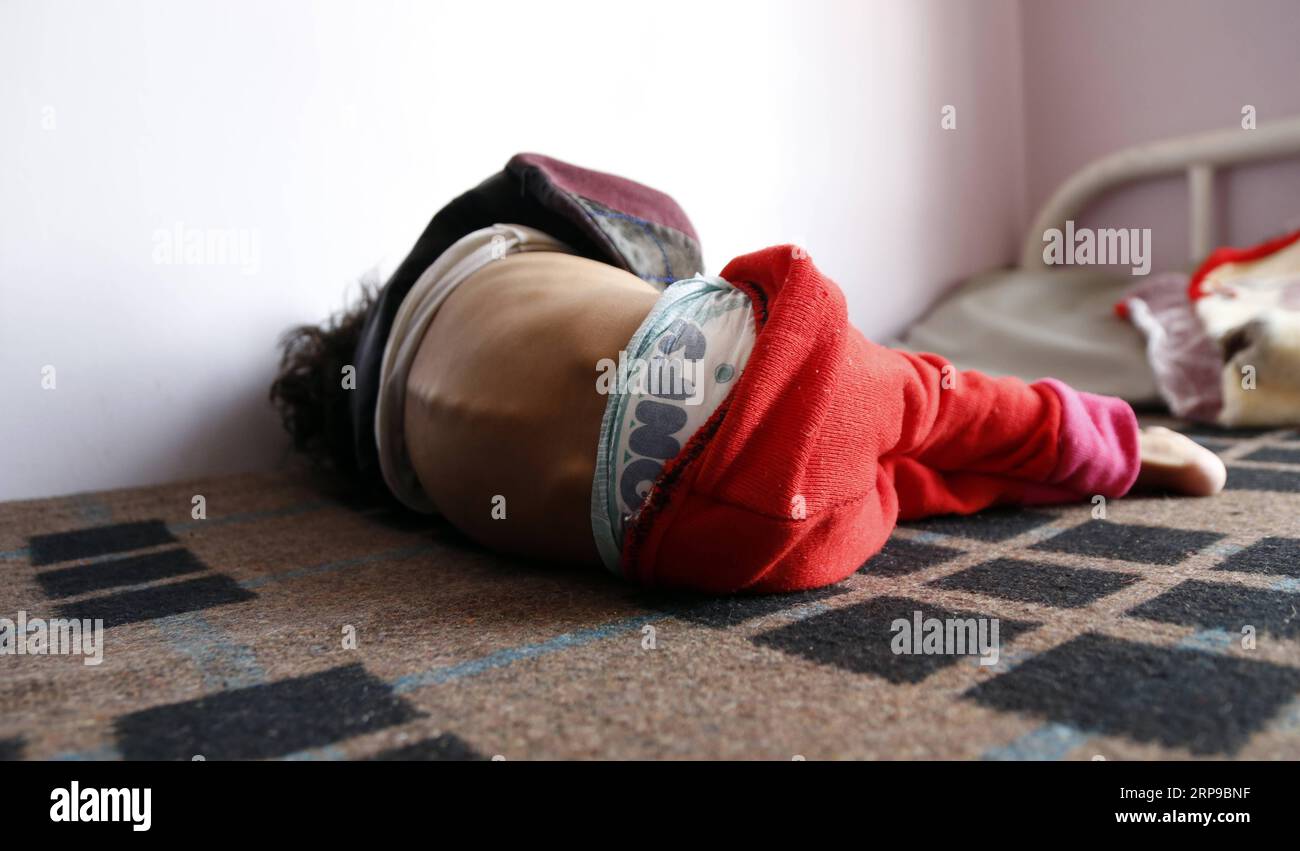 (190401) -- SANAA, 1 aprile 2019 -- Un bambino malnutrito si trova a letto mentre riceve cure mediche in un centro di assistenza per la malnutrizione a Sanaa, Yemen, il 1 aprile 2019. Secondo il Fondo delle Nazioni Unite per l'infanzia (UNICEF), circa 394.000 bambini yemeniti sotto i 5 anni soffrono di grave malnutrizione acuta e necessitano di cure. YEMEN-SANAA-BAMBINI-MALNUTRIZIONE MohammedxMohammed PUBLICATIONxNOTxINxCHN Foto Stock