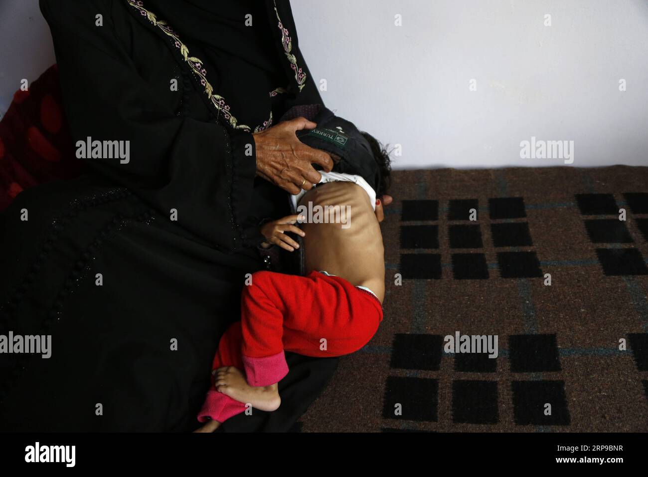(190401) -- SANAA, 1 aprile 2019 -- Una donna mostra il suo bambino malnutrito in un centro di cura per la malnutrizione a Sanaa, Yemen, il 1 aprile 2019. Secondo il Fondo delle Nazioni Unite per l'infanzia (UNICEF), circa 394.000 bambini yemeniti sotto i 5 anni soffrono di grave malnutrizione acuta e necessitano di cure. YEMEN-SANAA-BAMBINI-MALNUTRIZIONE MohammedxMohammed PUBLICATIONxNOTxINxCHN Foto Stock