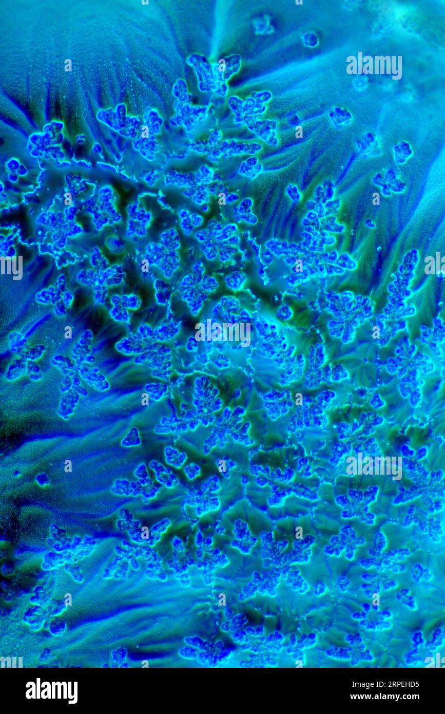L'immagine presenta la salsa di soia cristallizzata fotografata attraverso il microscopio a luce polarizzata con un ingrandimento di 100X. Foto Stock