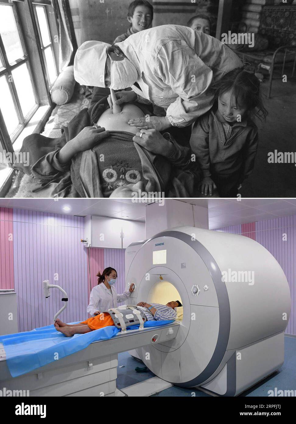 190926 -- PECHINO, 26 settembre 2019 Xinhua -- Top: File Photo scattato nel 1997 da Chogo mostra una donna incinta che riceve un esame fisico a Xigaze, nella regione autonoma del Tibet nel sud-ovest della Cina. In basso: La foto scattata il 15 maggio 2017 da Jigme Dorge mostra un medico che gestisce una macchina MRI a Lhasa, in Tibet. L'aspettativa di vita media delle persone in Tibet è salita a 70,6 anni, quasi il doppio rispetto ai 35,5 anni del 1959. Ora ci sono 1.548 strutture sanitarie che forniscono 19.787 posti letto in Tibet, con quasi 20.000 operatori sanitari e medici. Nel 1949, quando fu fondata la Repubblica Popolare Cinese, la C Foto Stock