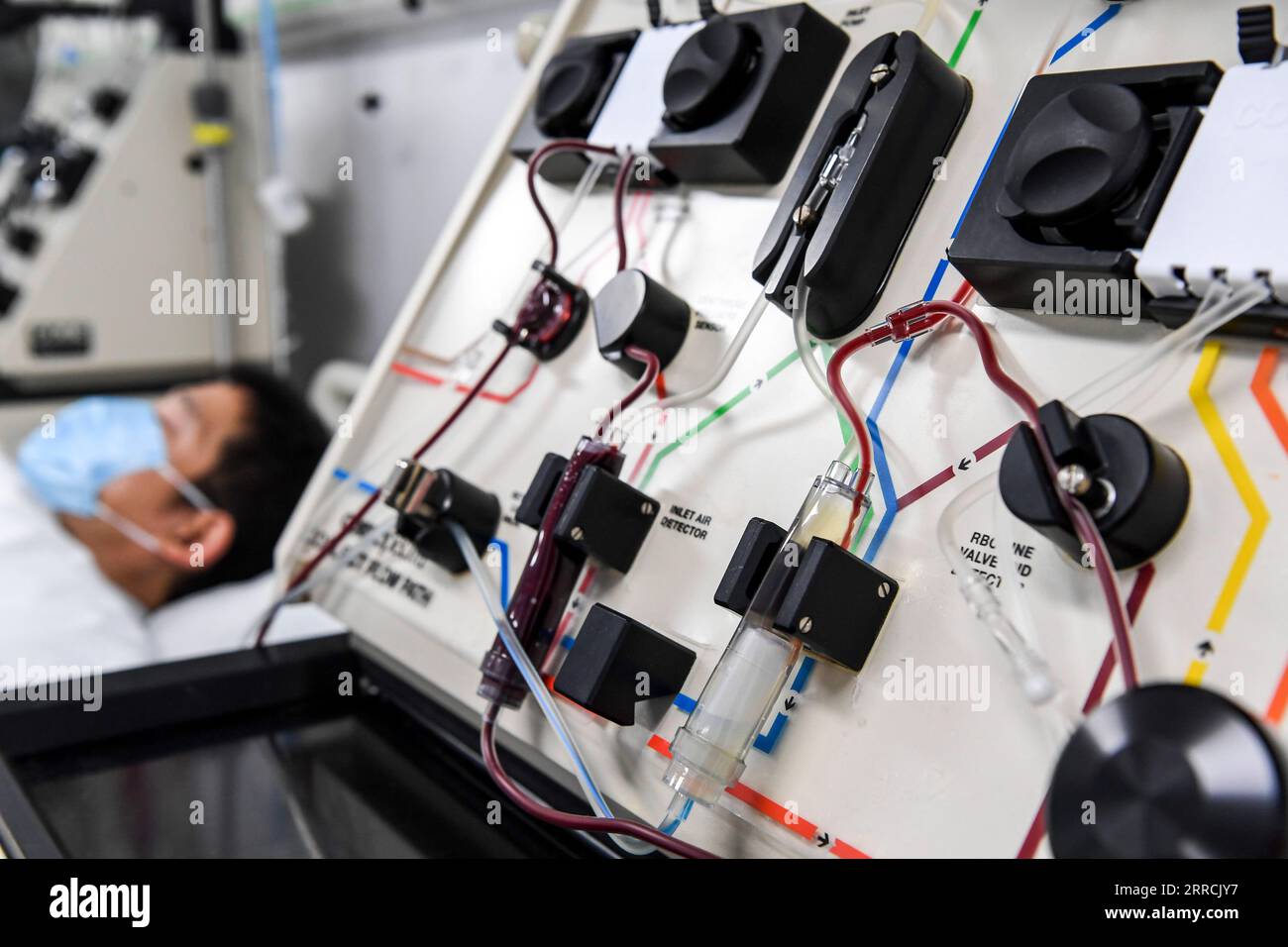 211108 -- NANNING, 8 novembre 2021 -- Dottor li dona le sue cellule staminali ematopoietiche al primo ospedale affiliato dell'Università medica del Guangxi a Nanning, nella Cina meridionale, nella regione autonoma del Guangxi Zhuang nel novembre del 2021. Li, un medico del dipartimento di ematologia del primo ospedale affiliato della Guangxi Medical University, registrato con China Marrow Donor Program CMDP come potenziali donatori di cellule staminali ematopoietiche HSC nel novembre del 2011. In qualità di medico che fornisce trattamenti con cellule staminali ematopoietiche per i pazienti, nel mese di agosto del 2021 si abbina con successo a un paziente come donatore di HSC. Li ha donato h Foto Stock