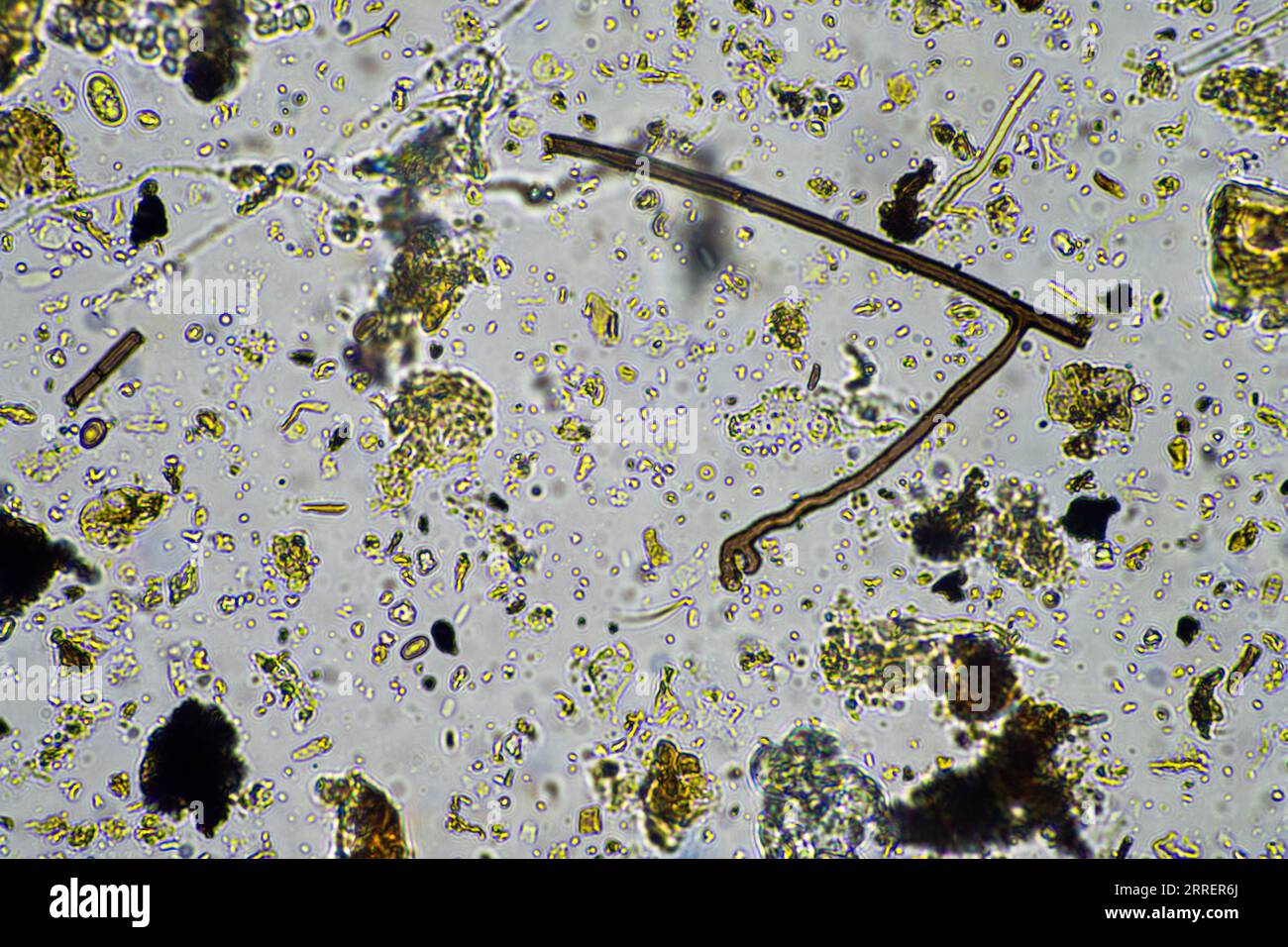 vita del suolo al microscopio con funghi del suolo e ifi fungine in un'azienda agricola Foto Stock