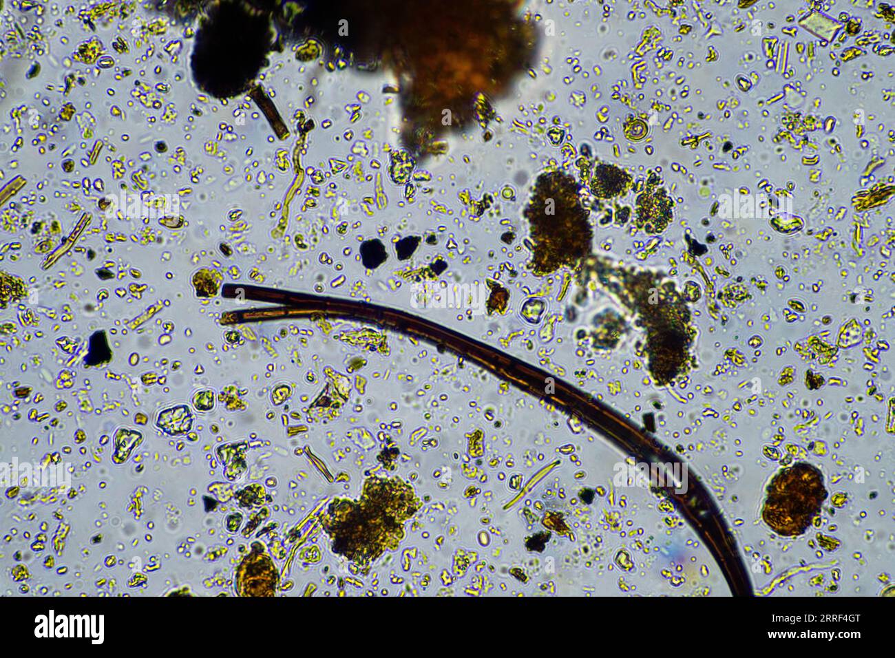 vita del suolo al microscopio con funghi del suolo e ifi fungine in un'azienda agricola Foto Stock