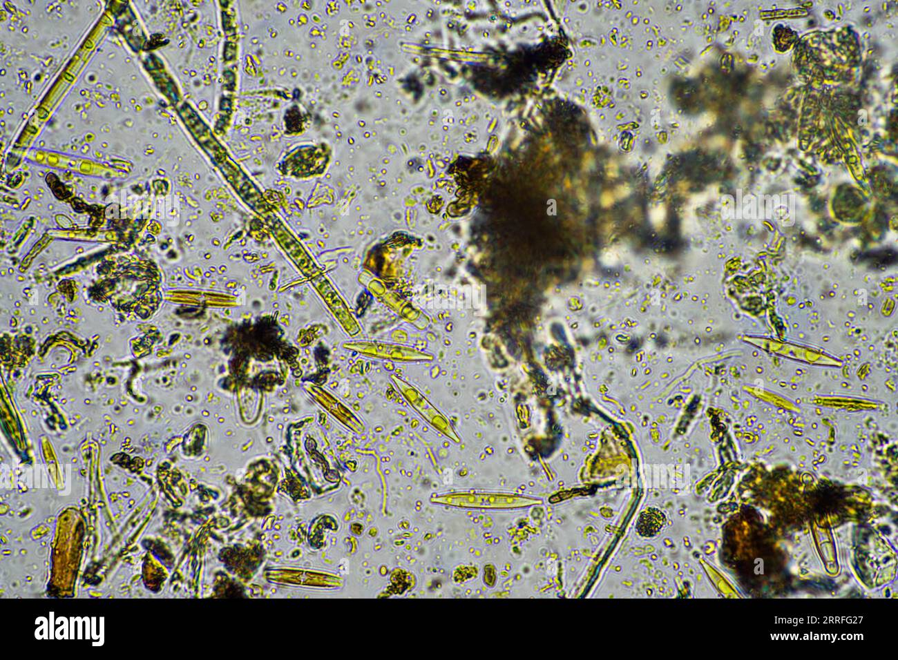 vita del suolo al microscopio con funghi del suolo e ifi fungine in un'azienda agricola Foto Stock