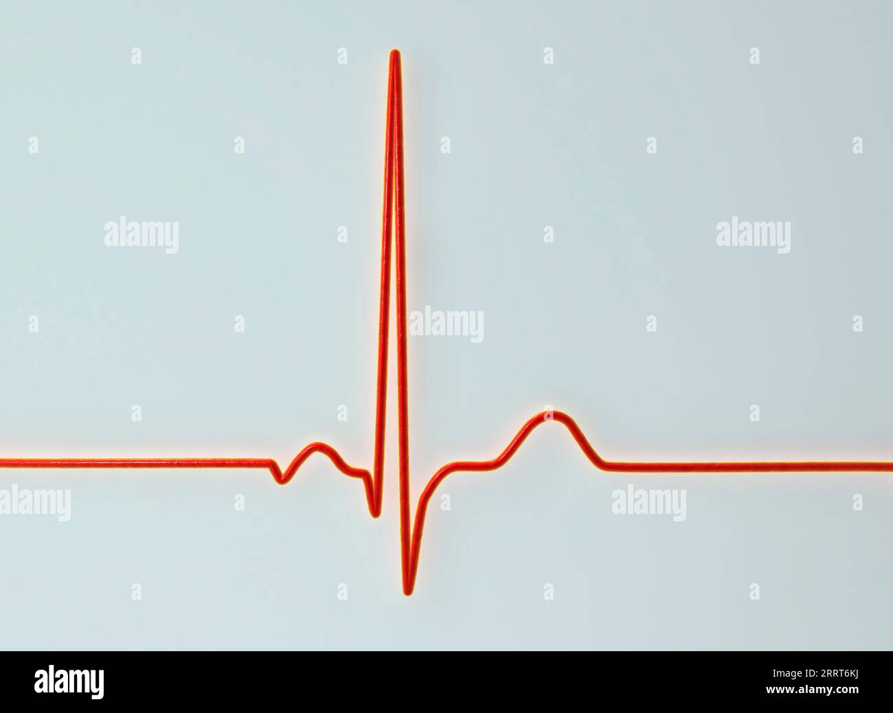 Ritmo cardiaco sano, illustrazione Foto Stock