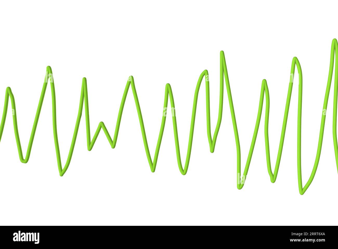Torsioni di punta ritmo del battito cardiaco, illustrazione Foto Stock