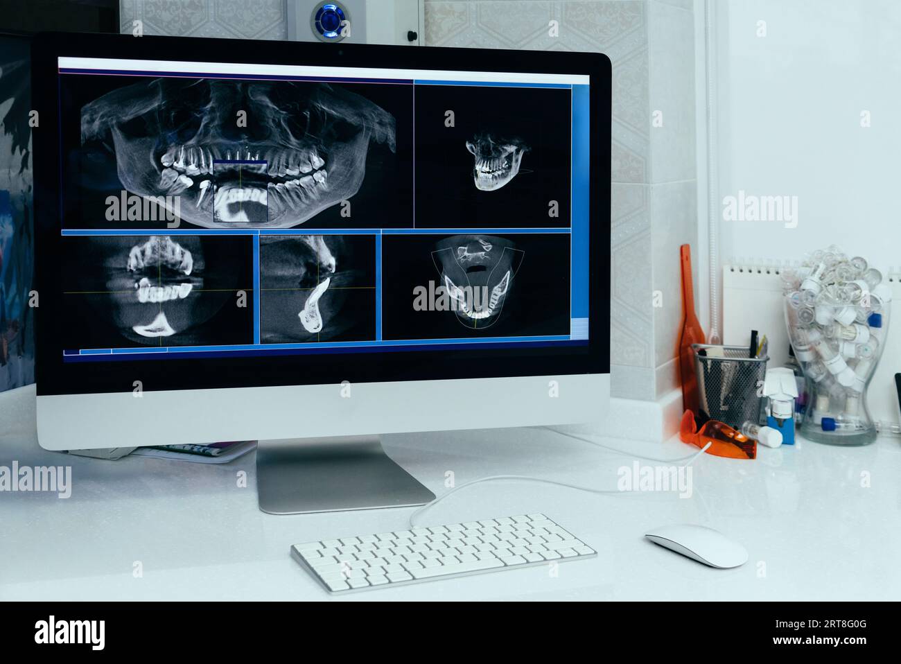 Immagine a raggi X di un computer nell'ufficio di un dentista. Foto Stock