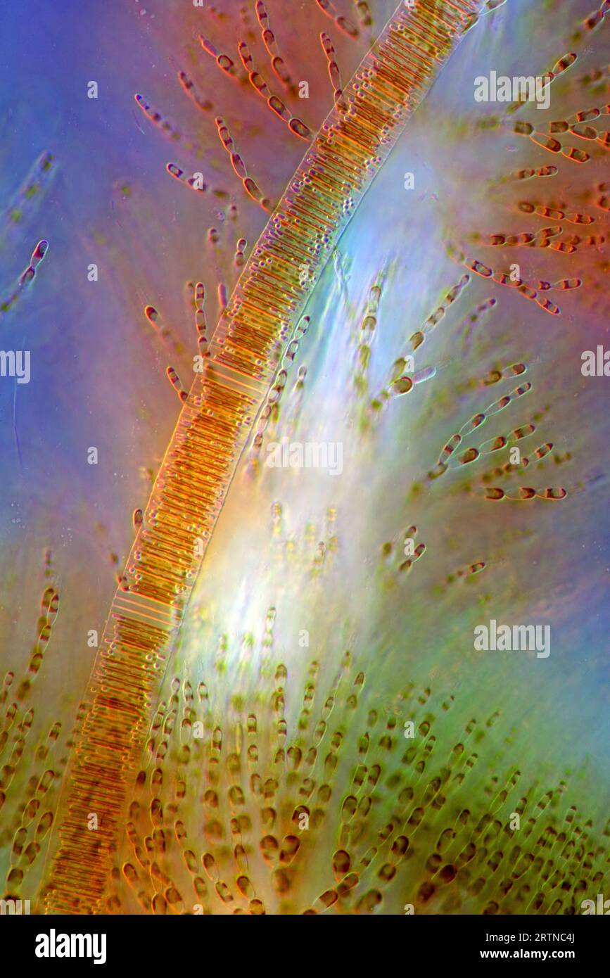 L'immagine presenta Fragilaria sp., una specie di diatomi e Batrachospermum sp., una specie di alghe rosse, fotografate attraverso il microscopio in li polarizzati Foto Stock