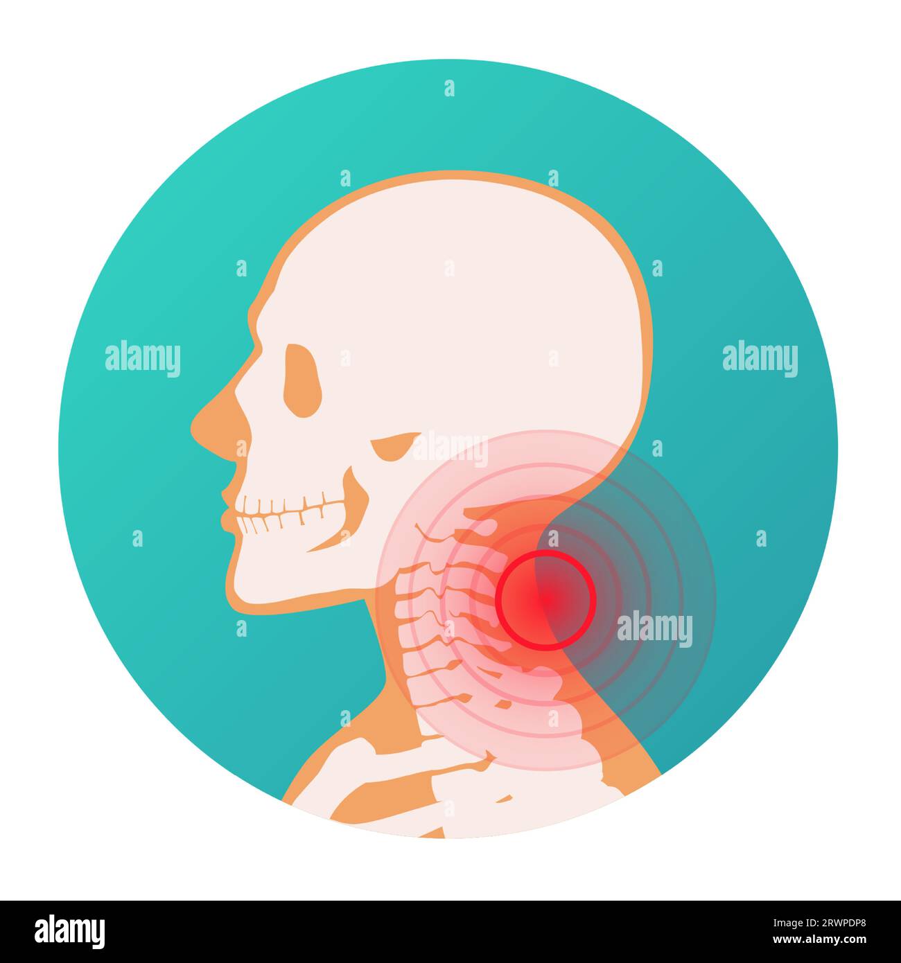 Localizzazione del dolore del cerchio rosso nel collo del corpo umano, scheletro, articolazioni e illustrazione del vettore osseo Illustrazione Vettoriale