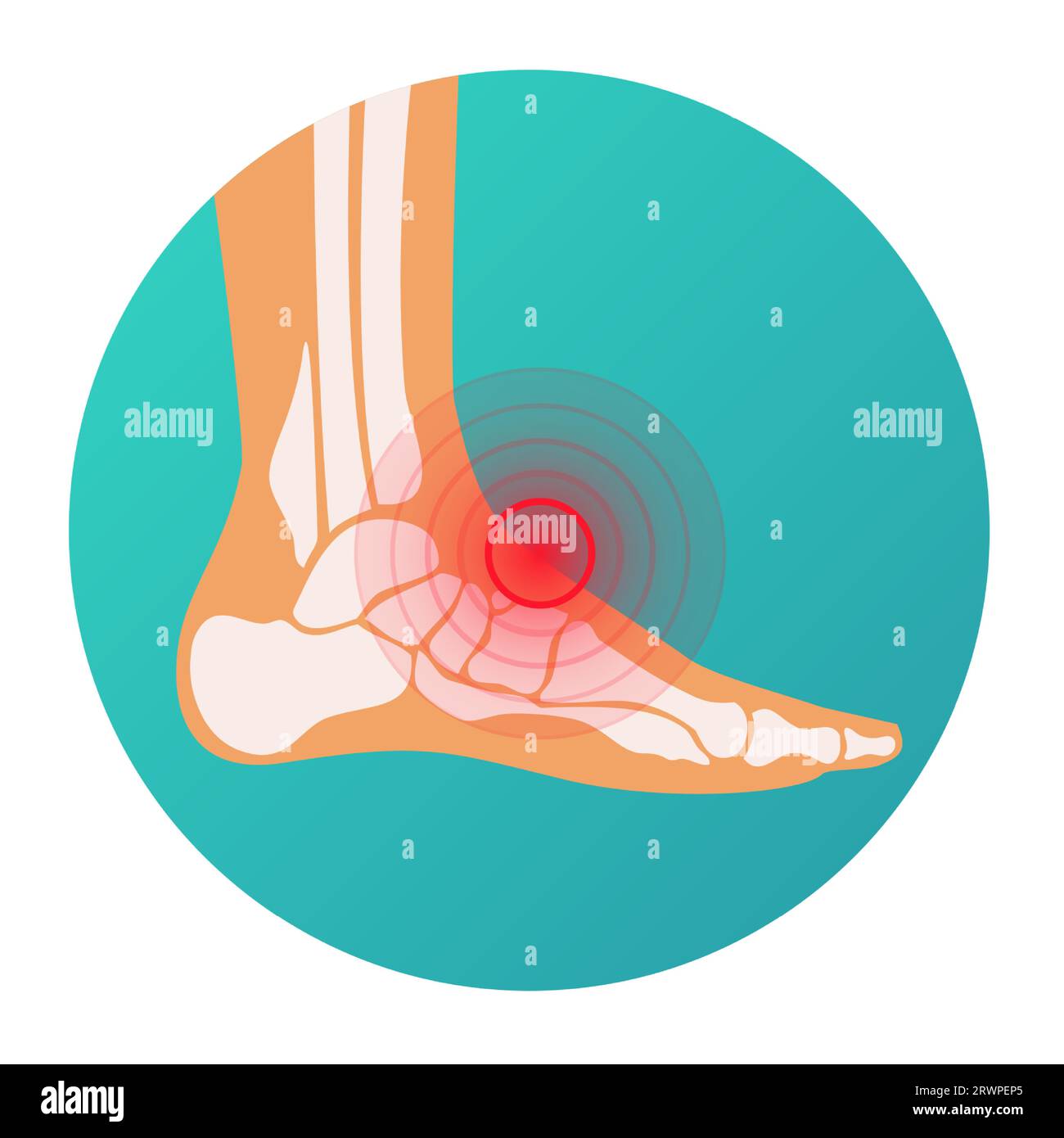 Localizzazione del dolore al cerchio rosso nel piede umano, lesioni ai piedi, scheletro, articolazioni e ossa Illustrazione Vettoriale